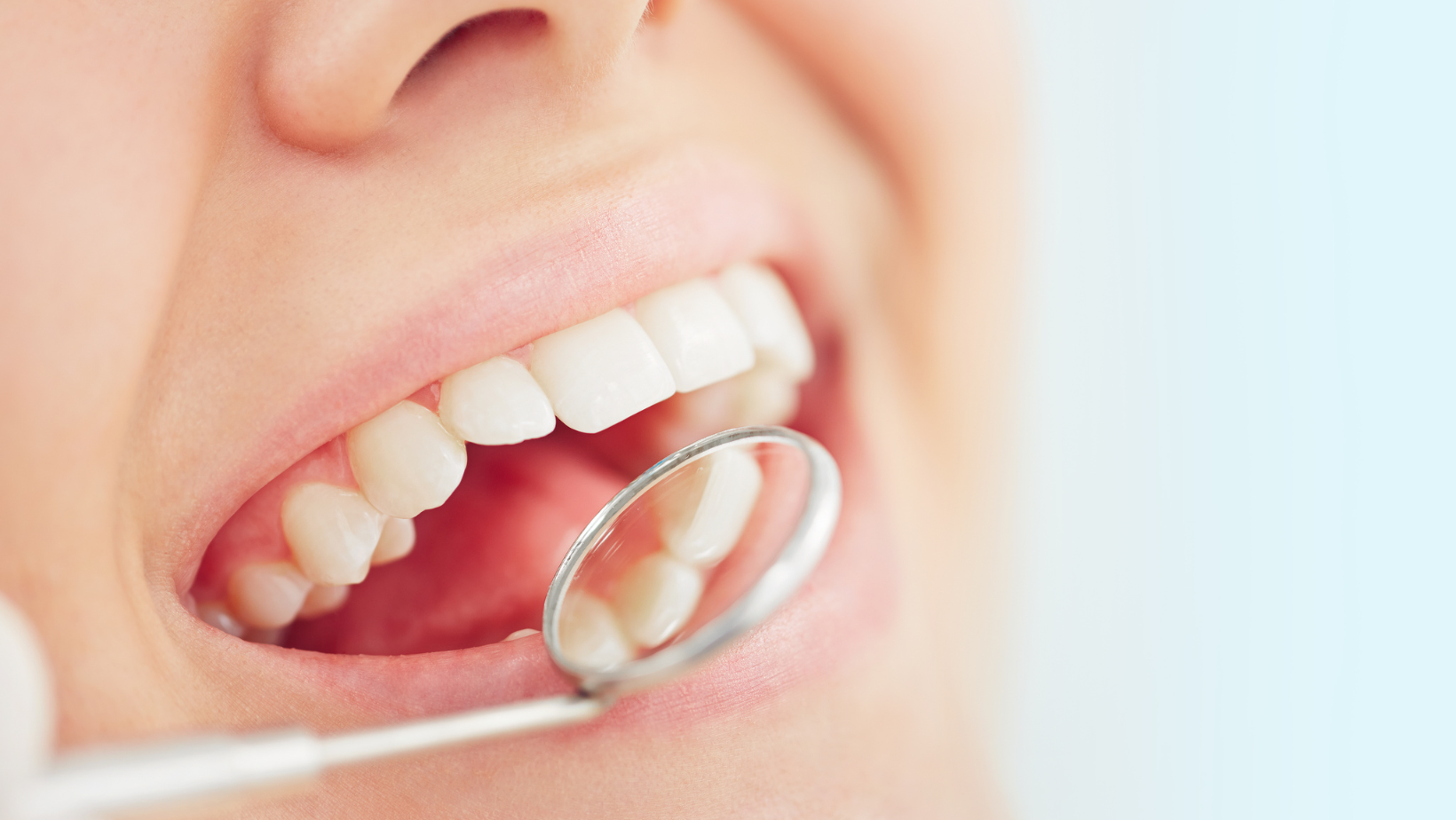endodontinis gydymas